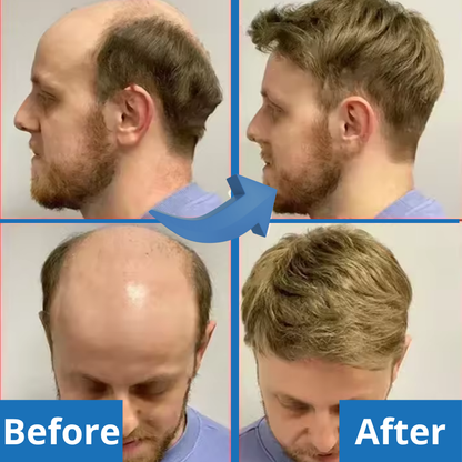 Hair Growth Serum Roll - On