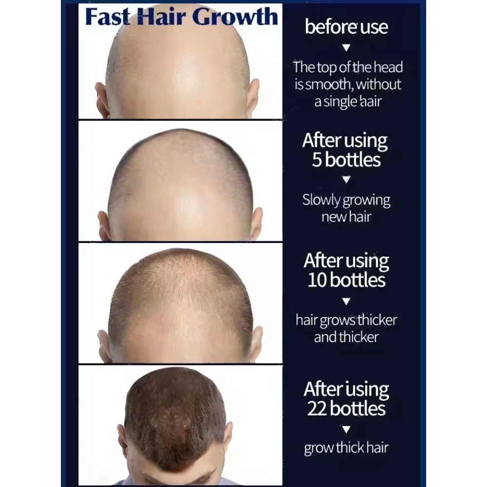 Hair Growth Serum Roll - On