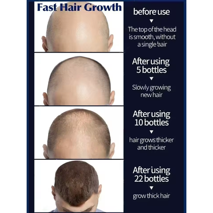 Hair Growth Serum Roll - On